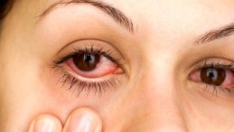 GÖZ KIZARIKLIĞINI HAFİFE ALMAYIN!